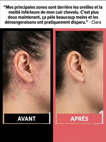 Soins Cuir Chevelu Bioméra